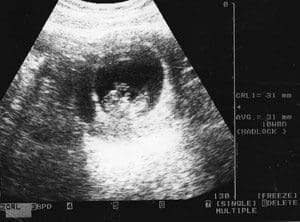 USEscans110-B2-Copy